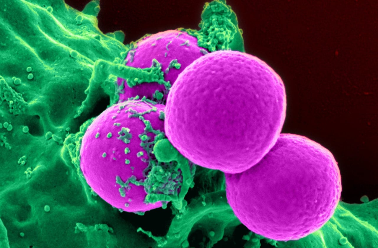 Dispositivo detecta câncer