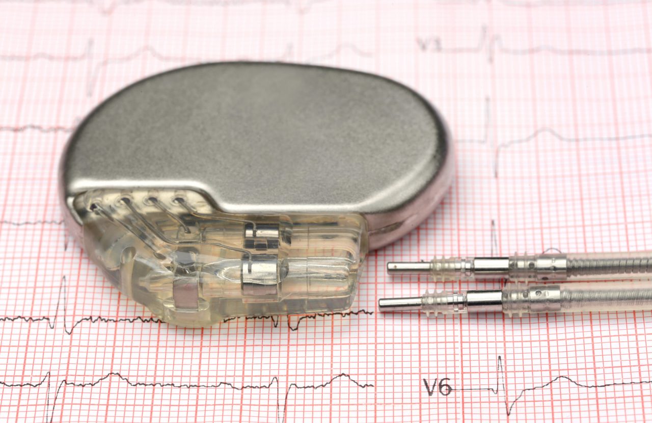 marca-passo em cima de eletrocardiograma