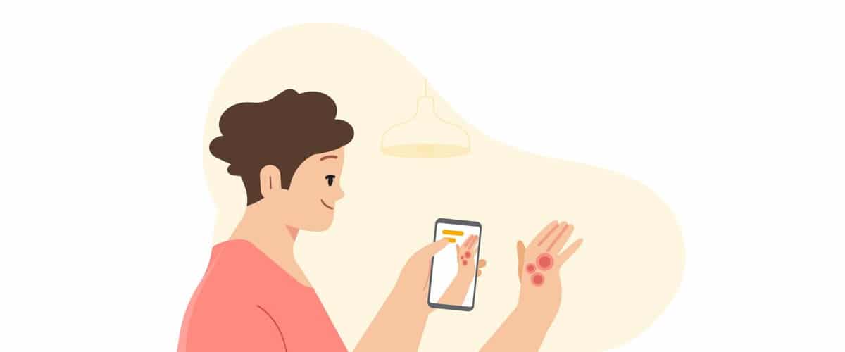 Google ferramenta problemas de pele