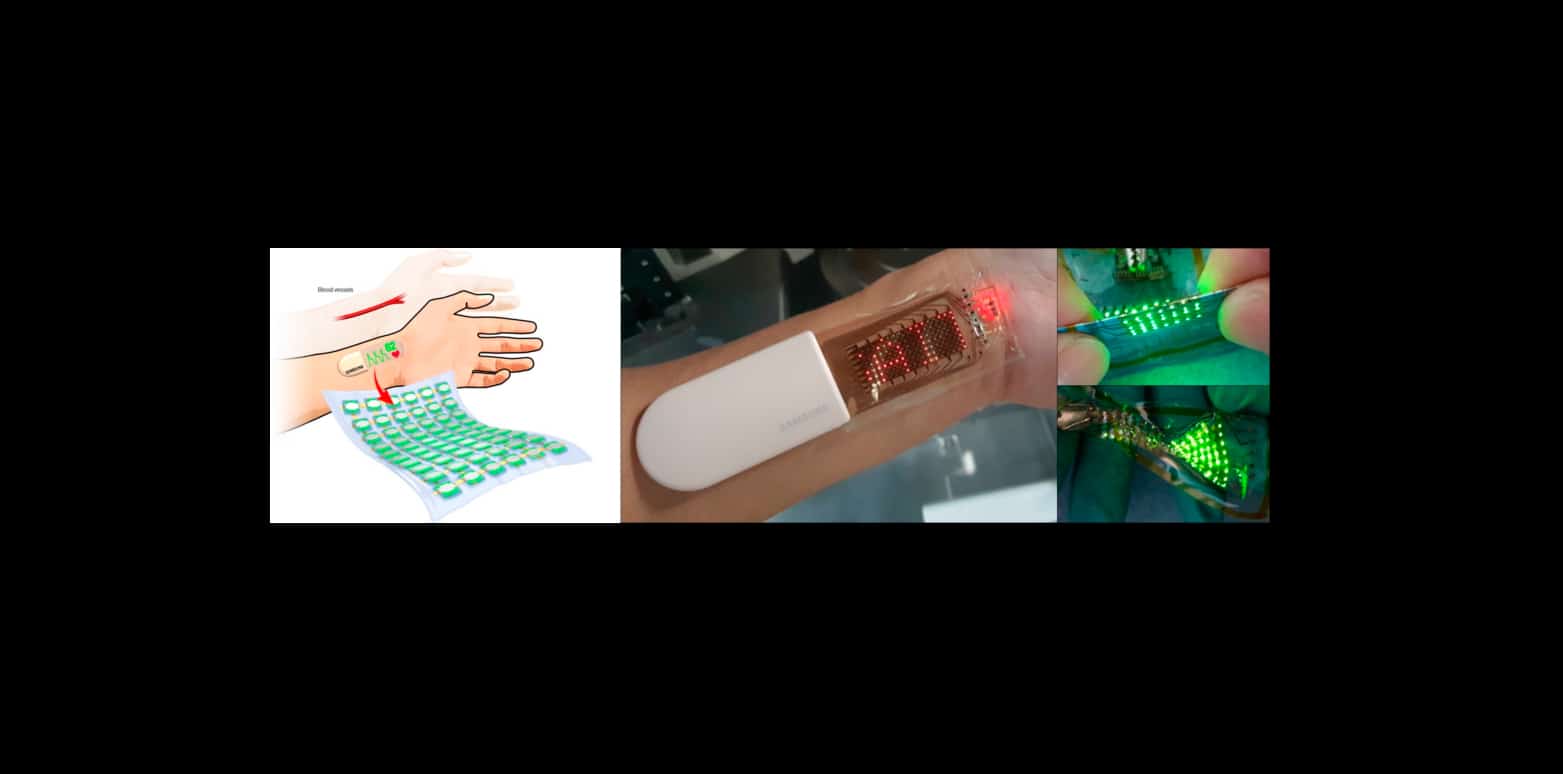 Gadget de saúde da Samsung com OLED elástico